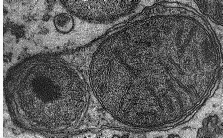 Golgi Apparatus and Lysosomes - Cell Organelles