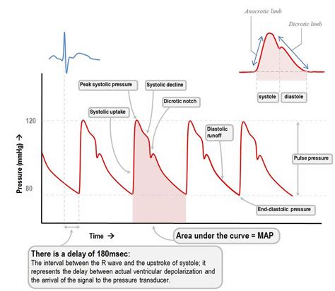 Normal arterial line waveforms | Arterial line, Diagnostic medical sonography, Cardiac nursing