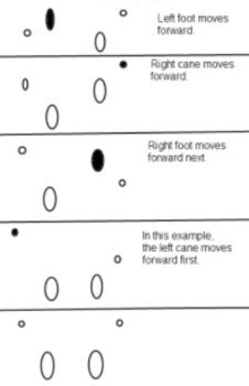 3REHAB - Assistive Aid Gait Patterns Flashcards | Quizlet