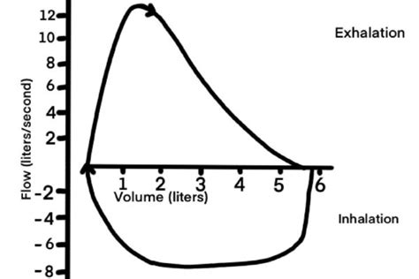 Pulmonary Flow Volume loops - Hospitalist X