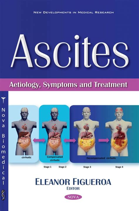 Ascites: Aetiology, Symptoms and Treatment – Nova Science Publishers