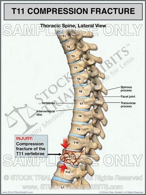 Pin on Stock Medical Exhibits