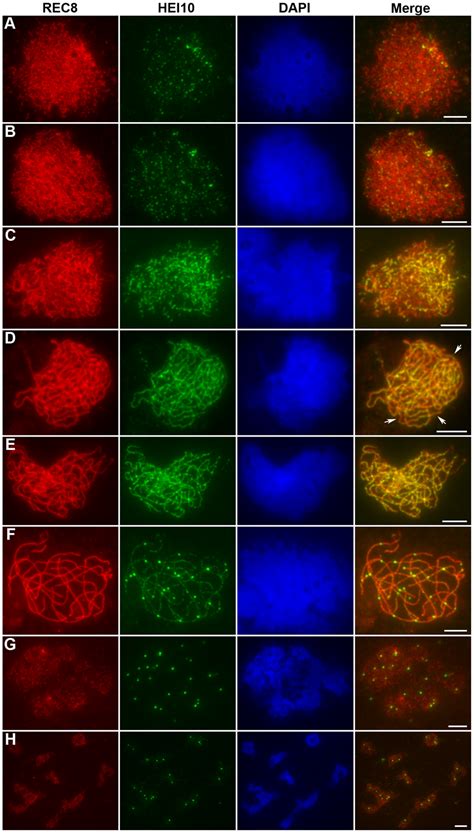 Immunolocalization of REC8 and HEI10 in WT rice. (A) Early leptotene,... | Download Scientific ...