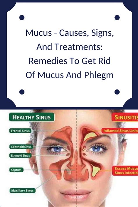 Causes Of Mucus In Throat