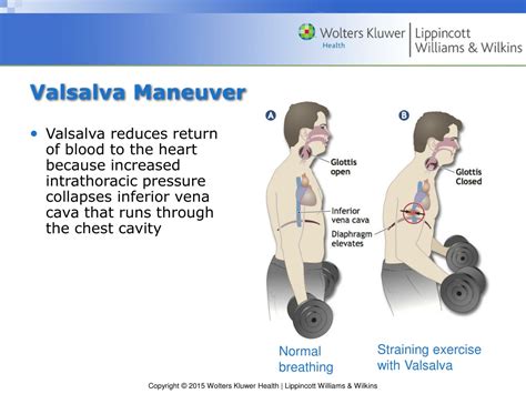 PPT - Chapter 12 Pulmonary Structure and Function PowerPoint ...