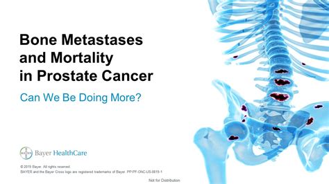 BONE METASTASES AND MORTALITY | Battle In The Bone