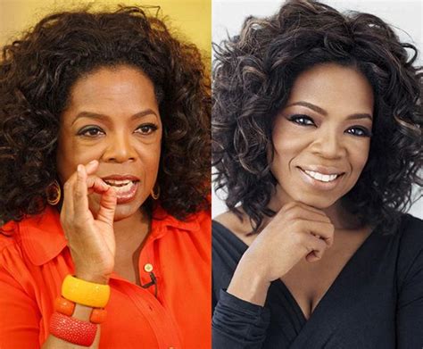 Oprah Winfrey Before and After Plastic Surgery - Life To Star | Nose ...