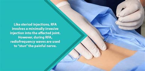 What is the success rate of nerve ablation? - Health Blog