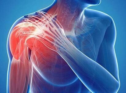 Shoulder Pain Causes, Symptoms, Diagnosis & Treatment