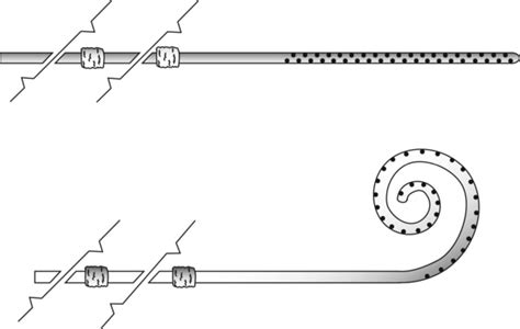 Tenckhoff peritoneal catheters | Media Asset | NIDDK