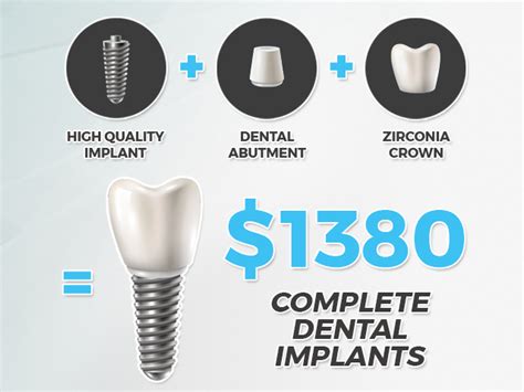 Cost of Dental Implants – Atlantic Dental Group