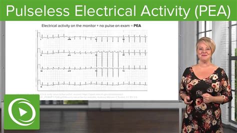 Pulseless Electrical Activity (PEA) – Emergency Medicine | Lecturio - YouTube