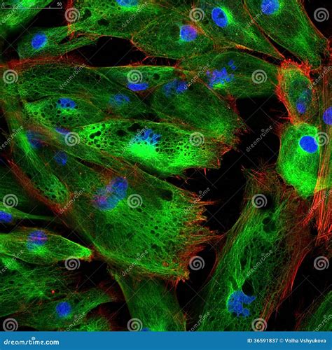 Fibroblasts (skin Cells) Labeled With Fluorescent Royalty Free Stock Photography - Image: 36591837