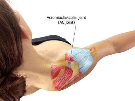 Acromioclavicular Joint (AC Joint) Injuries