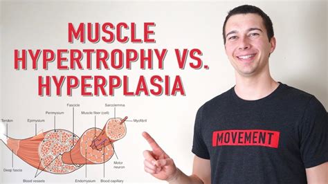 Muscle Hyperplasia