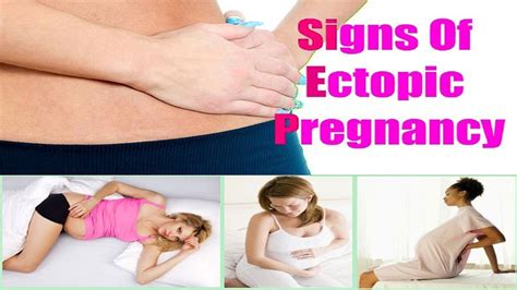 Ectopic Pregnancy (Symptoms, Signs, Treatment) - YouTube