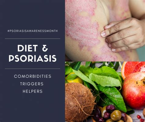 Diet and Psoriasis: Providing Evidence-Based Advice to our Patients - Next Steps in Dermatology