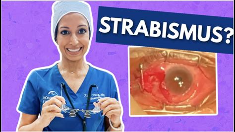 What To Expect With Strabismus Surgery | Eye Surgeon Explains - YouTube