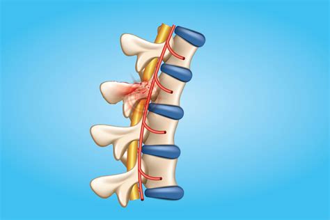 A Breakthrough in Spinal Cord Injuries | Rutgers University