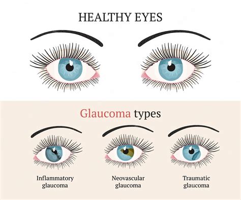 Premium Vector | Eye disease Ophthalmology health illustration