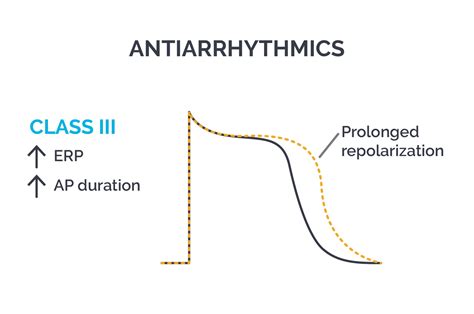 Class Antiarrhythmic Drugs (Potassium Channel Blockers), 60% OFF