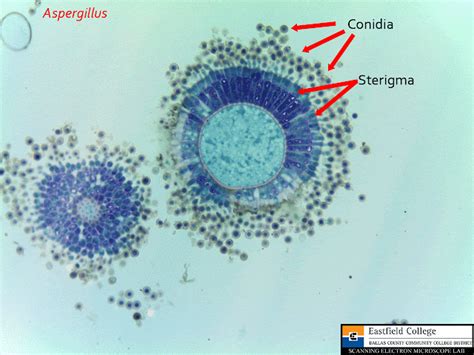 Scanning Electron Microscope Blog: Fungi - Images for Eastfield College ...