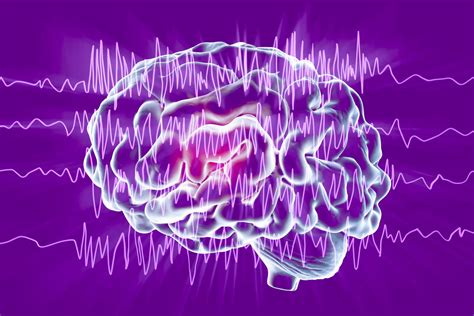 New Research Shows Why a Delayed Diagnosis of Focal Seizures Is So Dangerous