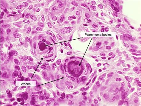 Can you solve this case? | Pathology Student