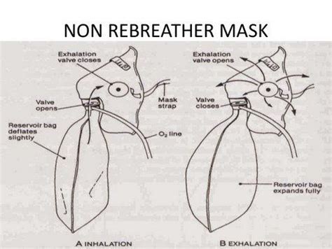 Image result for basic difference between non rebreather and venturi ...