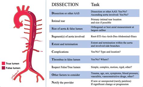 Understanding Aortic Dissection Causes Signs Symptoms Diagnosis | Porn Sex Picture