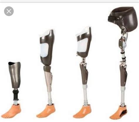 Lower Limb Prosthesis, Artificial Limbs, कृत्रिम अंग in Gango, Delhi , Rayon Rehablitation ...