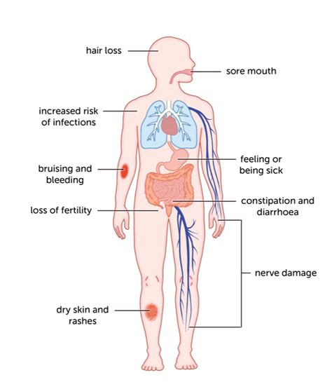 Chemotherapy - Liver Cancer UK