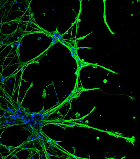 Fluorescence Microscopy (1): What is it? - HCS Pharma