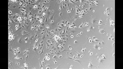 Time lapse of skin cells, known as keratinocytes, growing in the lab - YouTube