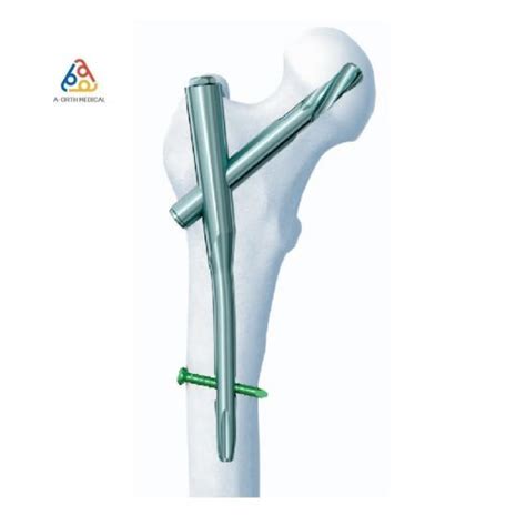 China Orthopedic Pfna Proximal Femoral Intramedullary Nail for Titanium Medical Surgical Trauma ...