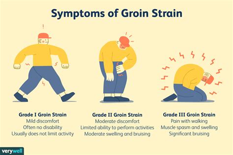 Diagnosing and Treating Groin Pulls