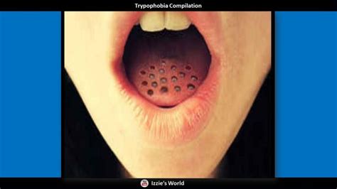 Pin on Trypophobia Images