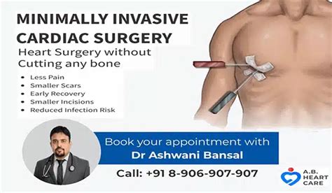 What is minimally invasive cardiac heart surgery in Chandigarh?