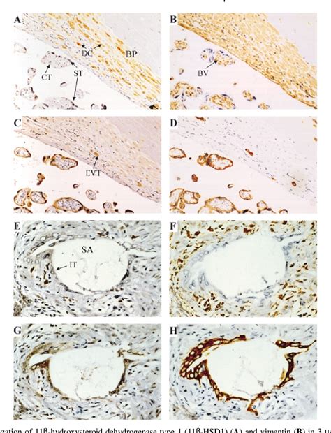 Figure 1 from Expression of 11β-hydroxysteroid dehydrogenase isozymes and corticosteroid hormone ...