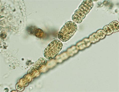 Anabaena planctonica (light micrograph) | Anabaena is a fila… | Flickr