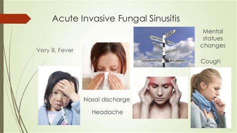 Fungal sinusitis