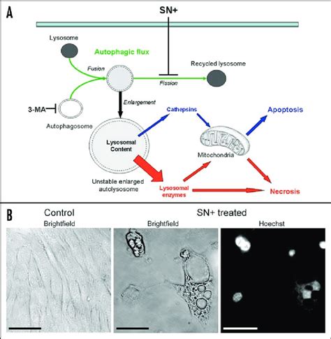 (A) Hypothetical model of autophagy-driven cell death decision maker. A ...