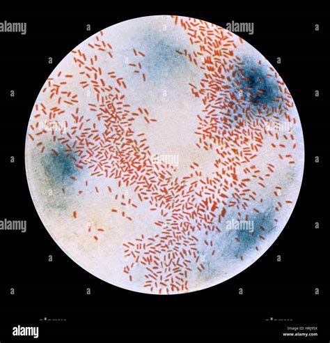 Haemophilus influenzae Bacteria, Gram-stain Technique, LM Stock Photo - Alamy