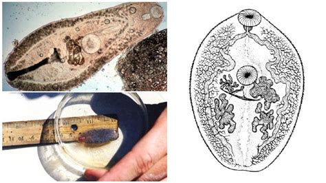 Trematodes - structure, life cycle, species