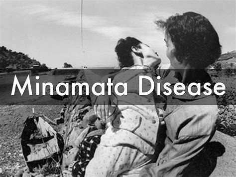 Minamata Disease by Carissa Perusset