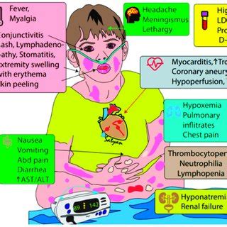 Mis-C Covid Rash / Mis C Kids With Coronavirus Related Inflammatory ...