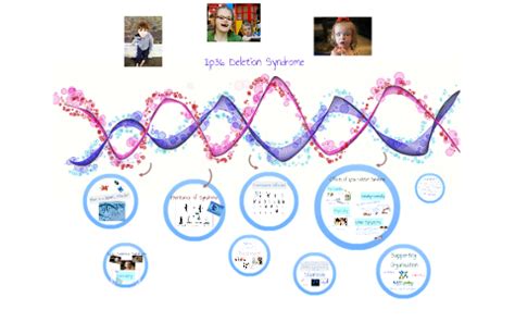 Monosomy 1p36 Syndrome by Wendy Truong