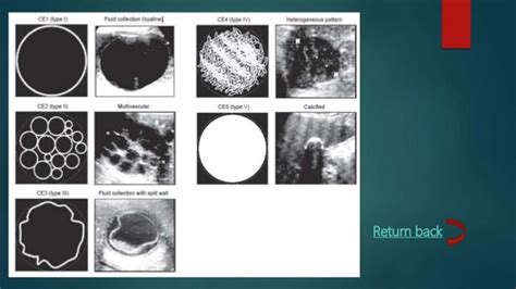 Echinococcosis, signs and symptoms, diagnosis and management.