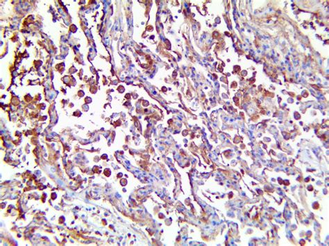 Treponema Pallidum Antibody (RPab) - Bio SB