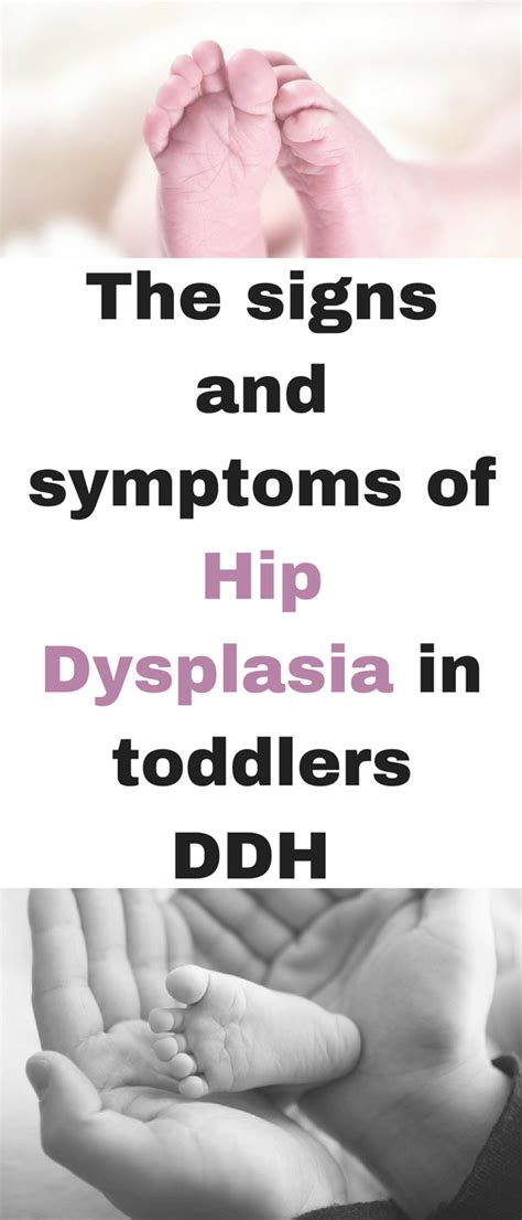 The signs and symptoms of hip dysplasia in toddlers ddh – Artofit